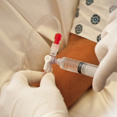Elcam medical stopcocks for controlled fluid management in clinical use