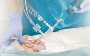 Y-Click™: New Approach to Hemostatic Valve Technology for PTCA Procedures